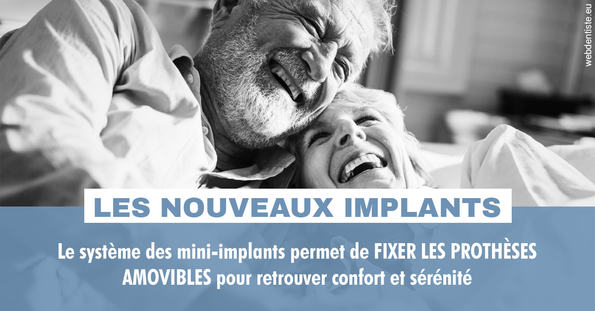 https://dr-fontaine-philippe.chirurgiens-dentistes.fr/Les nouveaux implants 2