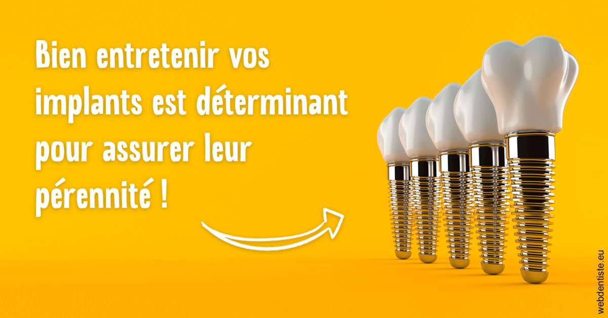https://dr-fontaine-philippe.chirurgiens-dentistes.fr/Entretien implants 2
