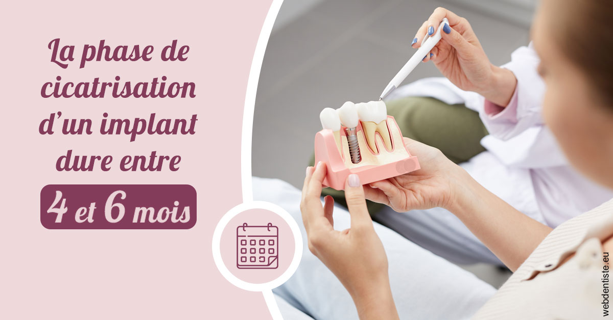 https://dr-fontaine-philippe.chirurgiens-dentistes.fr/Cicatrisation implant 2