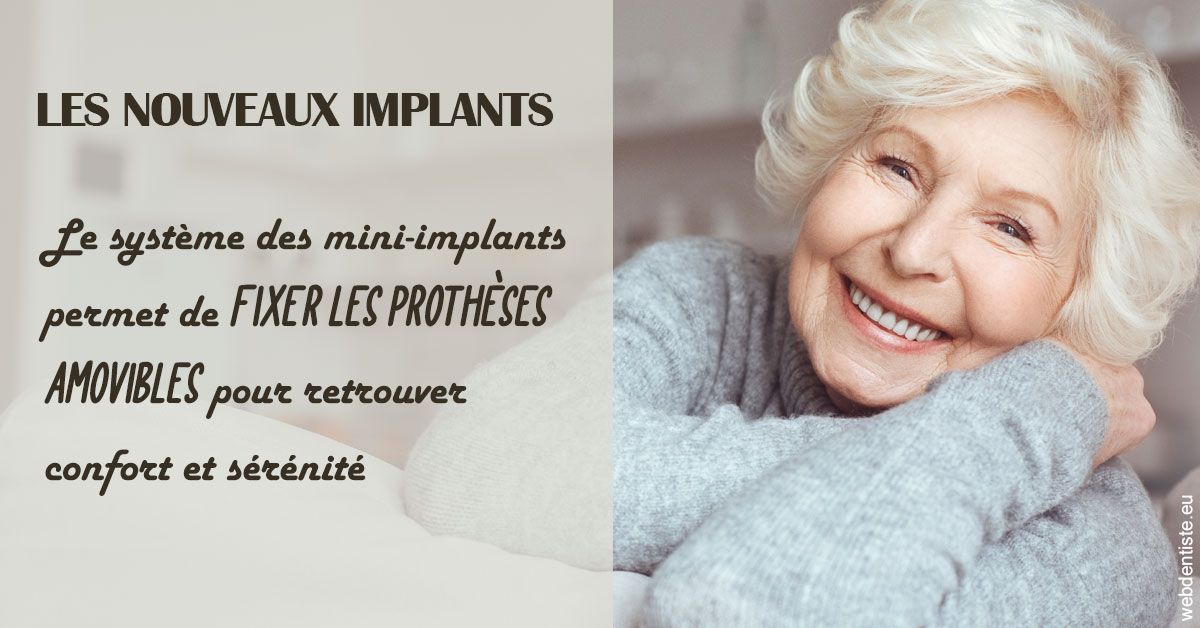 https://dr-fontaine-philippe.chirurgiens-dentistes.fr/Les nouveaux implants 1