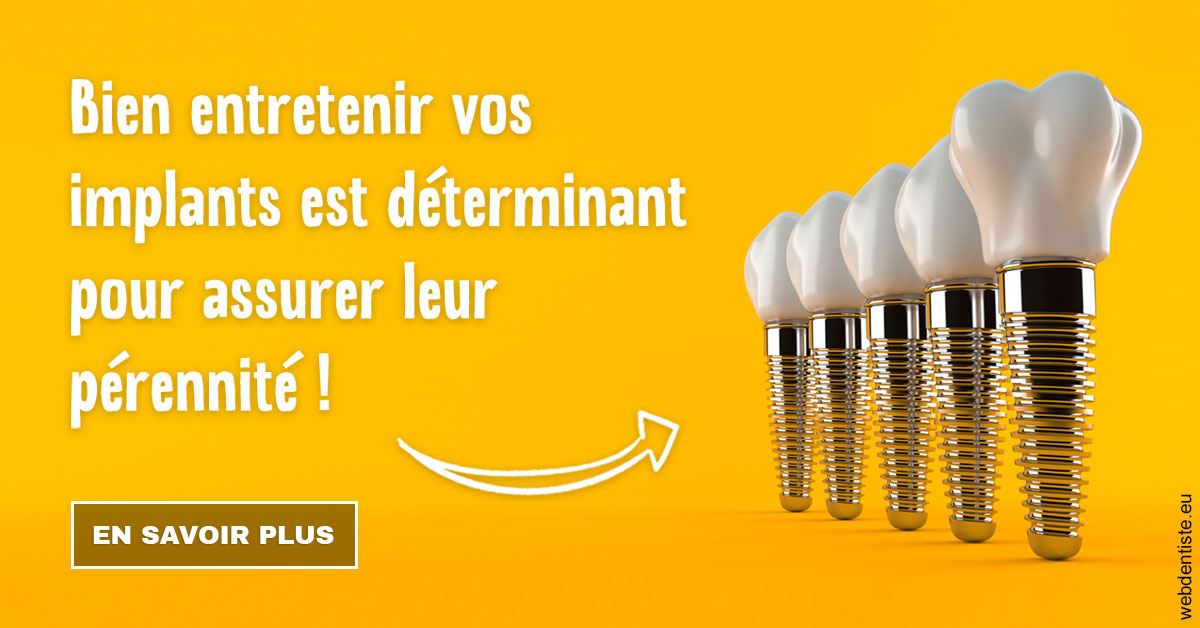 https://dr-fontaine-philippe.chirurgiens-dentistes.fr/Entretien implants 2