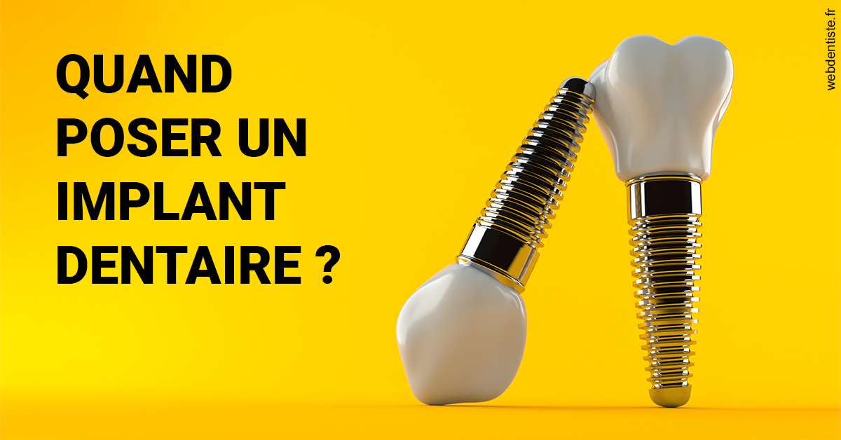 https://dr-fontaine-philippe.chirurgiens-dentistes.fr/Les implants 2