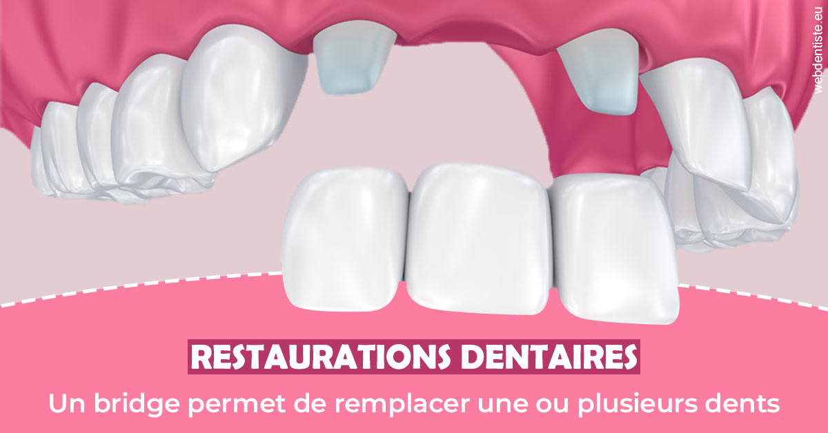 https://dr-fontaine-philippe.chirurgiens-dentistes.fr/Bridge remplacer dents 2