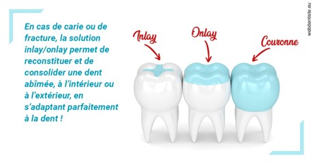 https://dr-fontaine-philippe.chirurgiens-dentistes.fr/L'INLAY ou l'ONLAY