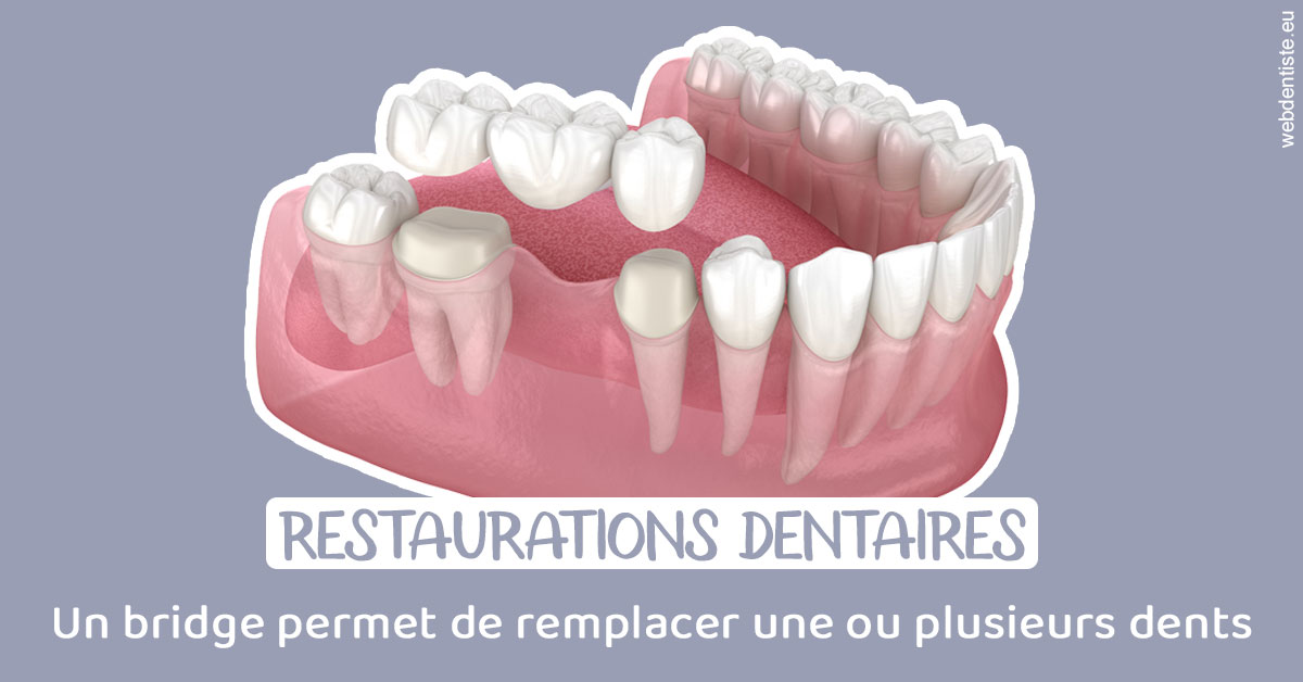 https://dr-fontaine-philippe.chirurgiens-dentistes.fr/Bridge remplacer dents 1