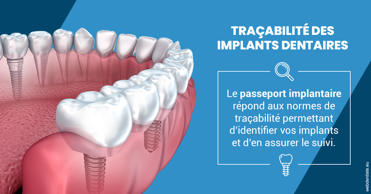 https://dr-fontaine-philippe.chirurgiens-dentistes.fr/T2 2023 - Traçabilité des implants 1