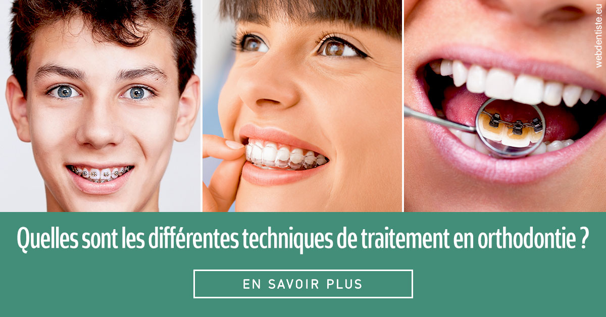 https://dr-fontaine-philippe.chirurgiens-dentistes.fr/Les différentes techniques de traitement 2