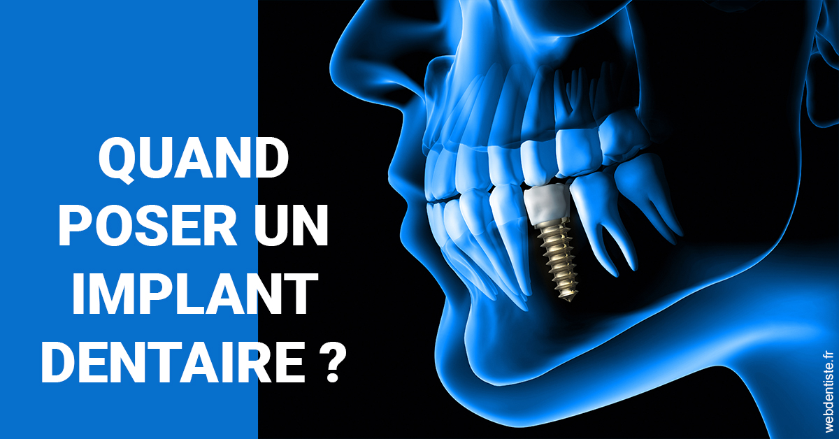 https://dr-fontaine-philippe.chirurgiens-dentistes.fr/Les implants 1
