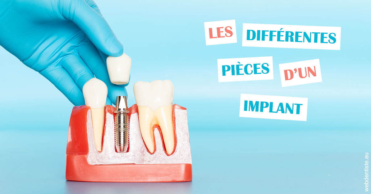 https://dr-fontaine-philippe.chirurgiens-dentistes.fr/Les différentes pièces d’un implant 2