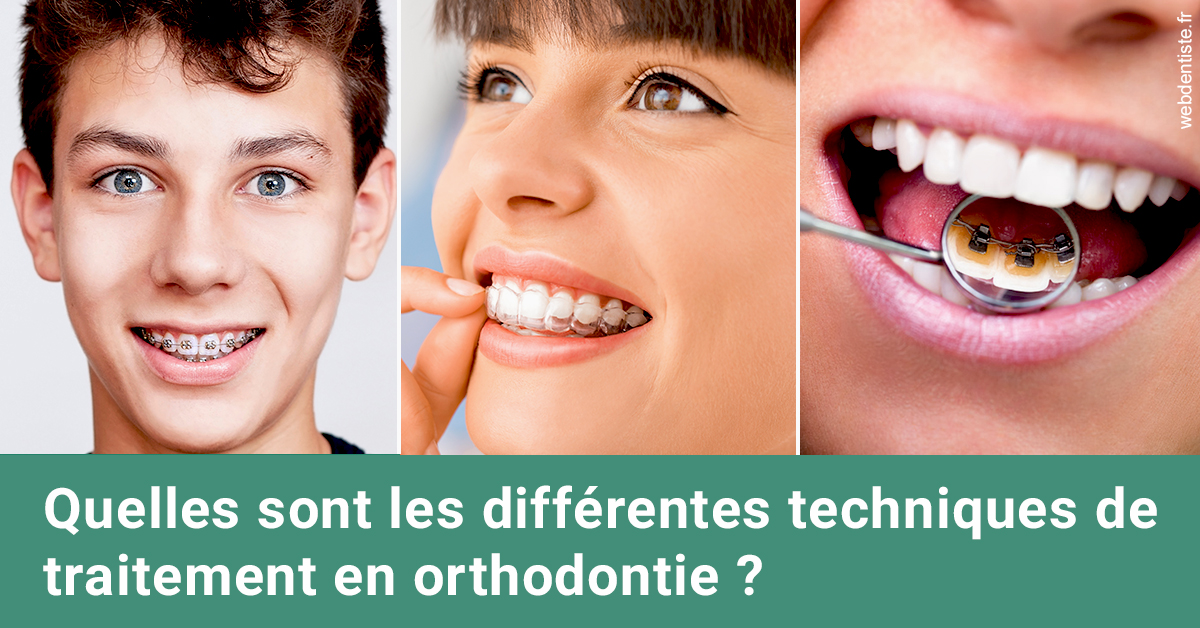 https://dr-fontaine-philippe.chirurgiens-dentistes.fr/Les différentes techniques de traitement 2