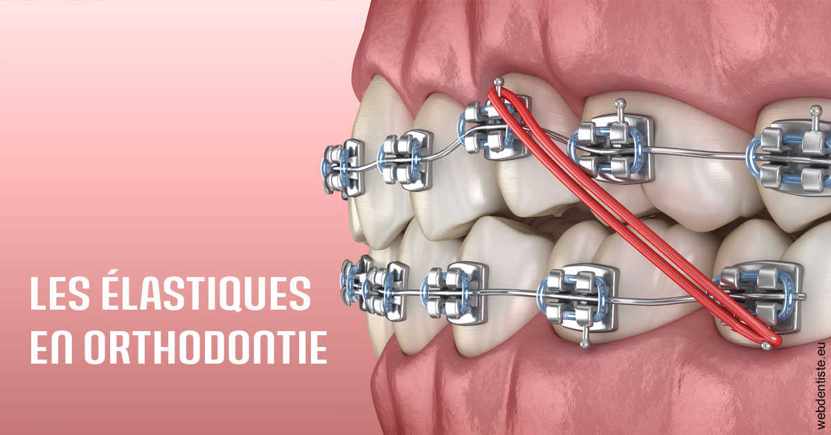 https://dr-fontaine-philippe.chirurgiens-dentistes.fr/Elastiques orthodontie 2