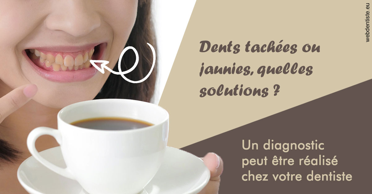 https://dr-fontaine-philippe.chirurgiens-dentistes.fr/Dents tachées 1