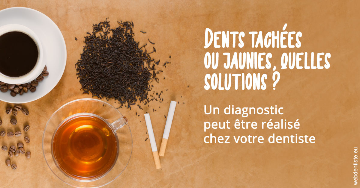 https://dr-fontaine-philippe.chirurgiens-dentistes.fr/Dents tachées 2