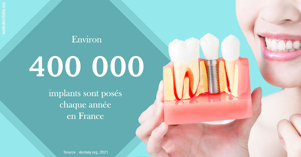 https://dr-fontaine-philippe.chirurgiens-dentistes.fr/Pose d'implants en France 2